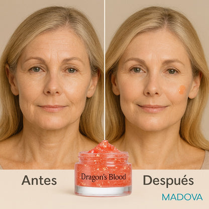 Crema Hidratante Sangre de Dragón (1 + 2 GRATIS)  -  Rejuvenece 10 Años - MADOVA  ¡¡OFERTA BLACK FRIDAY!!