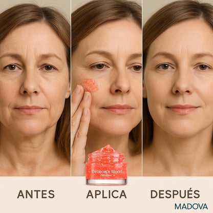 Crema Hidratante Sangre de Dragón (1 + 2 GRATIS)  -  Rejuvenece 10 Años - MADOVA  ¡¡OFERTA BLACK FRIDAY!!